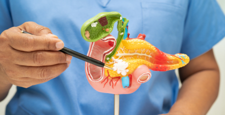 Alterações na microbiota intestinal como fatores cruciais no desenvolvimento e progressão do cancro do pâncreas