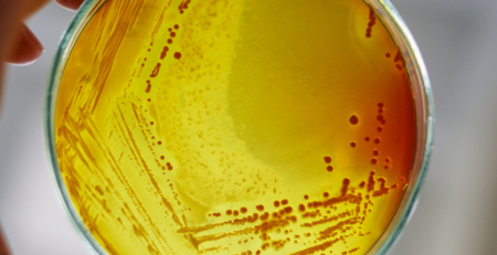 Estudo identificou bactérias intestinais associadas ao risco de AVC