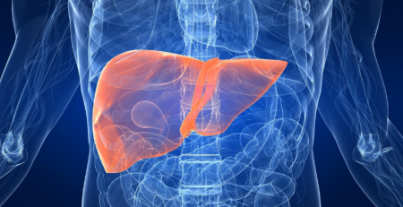 Rigidez hepática sobrestimada nos doentes com hepatite B crónica e a esteatose hepática não-alcoólica