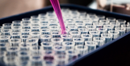 Investigadores do i3S descobrem método mais rápido de identificação e diagnóstico do cancro do estômago