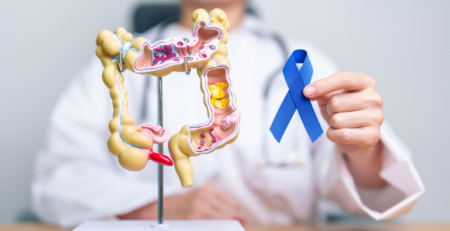 Estudo internacional com participação portuguesa mostra que idade e localização influenciam mutações no cancro colorretal
