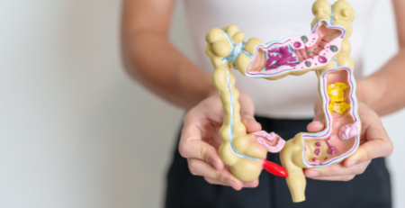 Cancro colorretal e microbioma: novo estudo recruta 400 doentes para desenvolver teste de diagnóstico não invasivo