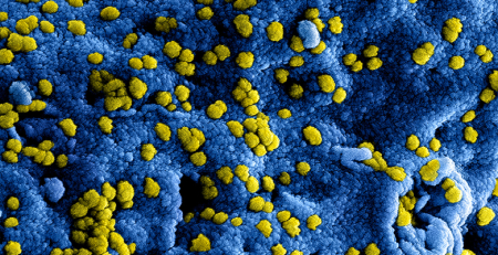Estudo mostra que as bactérias resistentes a antibióticos no intestino tornam C. difficile mais infecioso