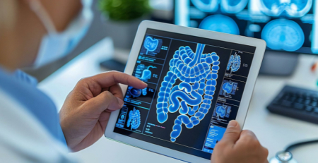 Estudo inovador mostra possível relação entre a microbiota intestinal e progressão de CCR
